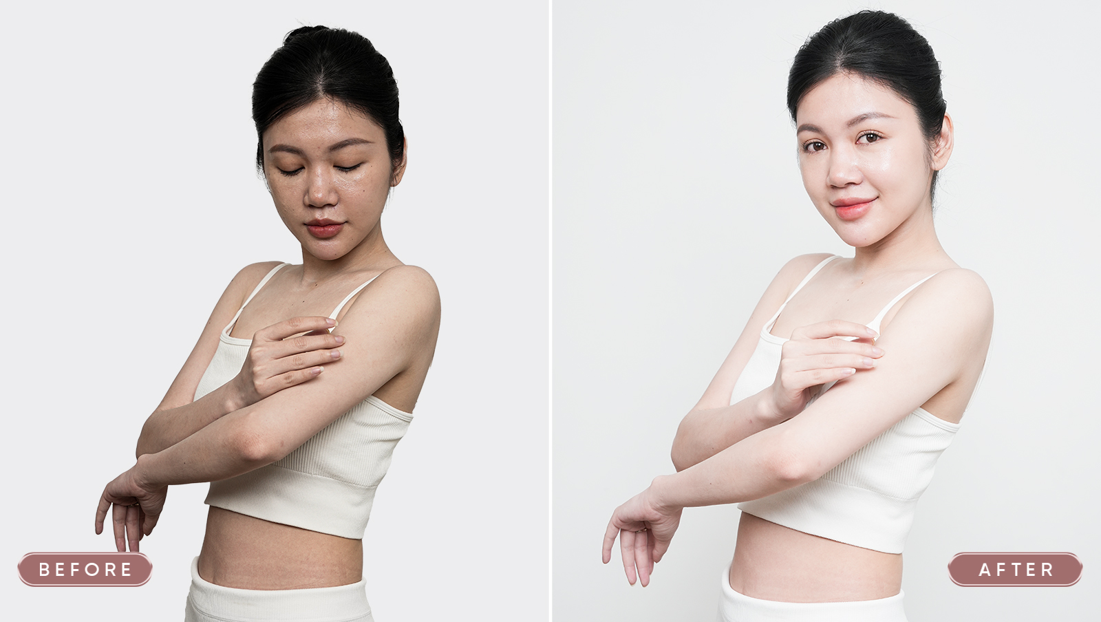 Case điều trị tắm trắng BIO LIGHT 6D
