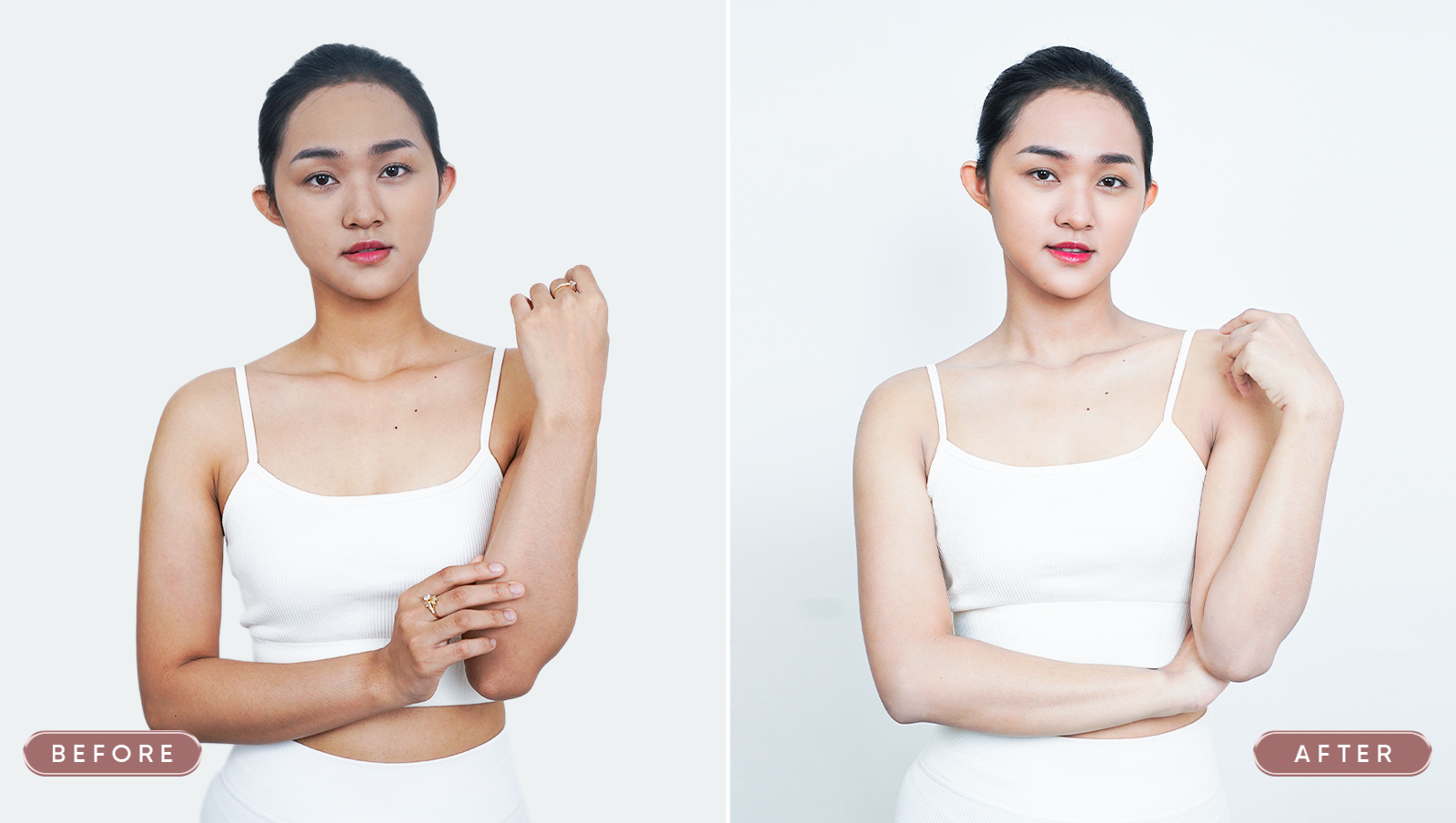 Case điều trị tắm trắng BIO LIGHT 6D