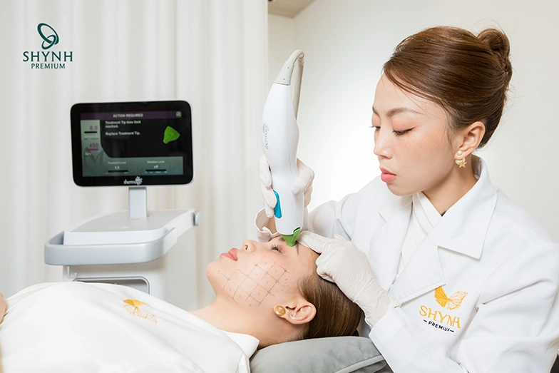 Cơ chế hoạt động của Thermage là dùng sóng tần số vô tuyến dung đơn cực