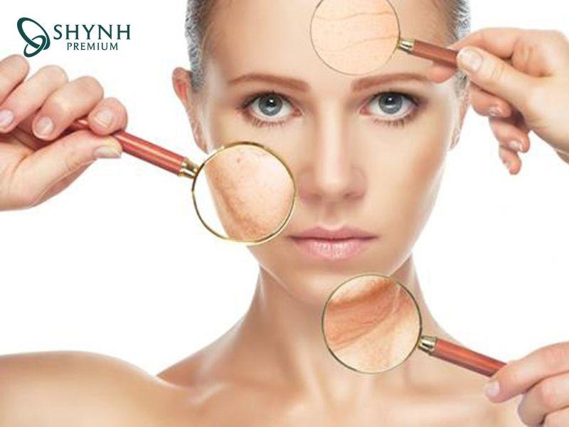 Da mặt bị chùng nhão, ảnh hưởng tới thẩm mỹ và tâm lý