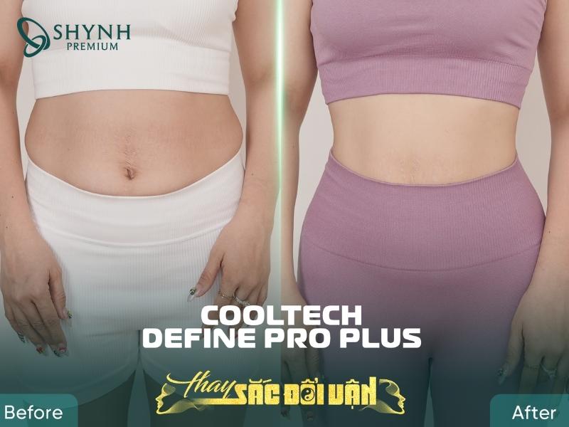 Hình ảnh khách hàng sử dụng liệu trình Cooltech Define Pro Plus