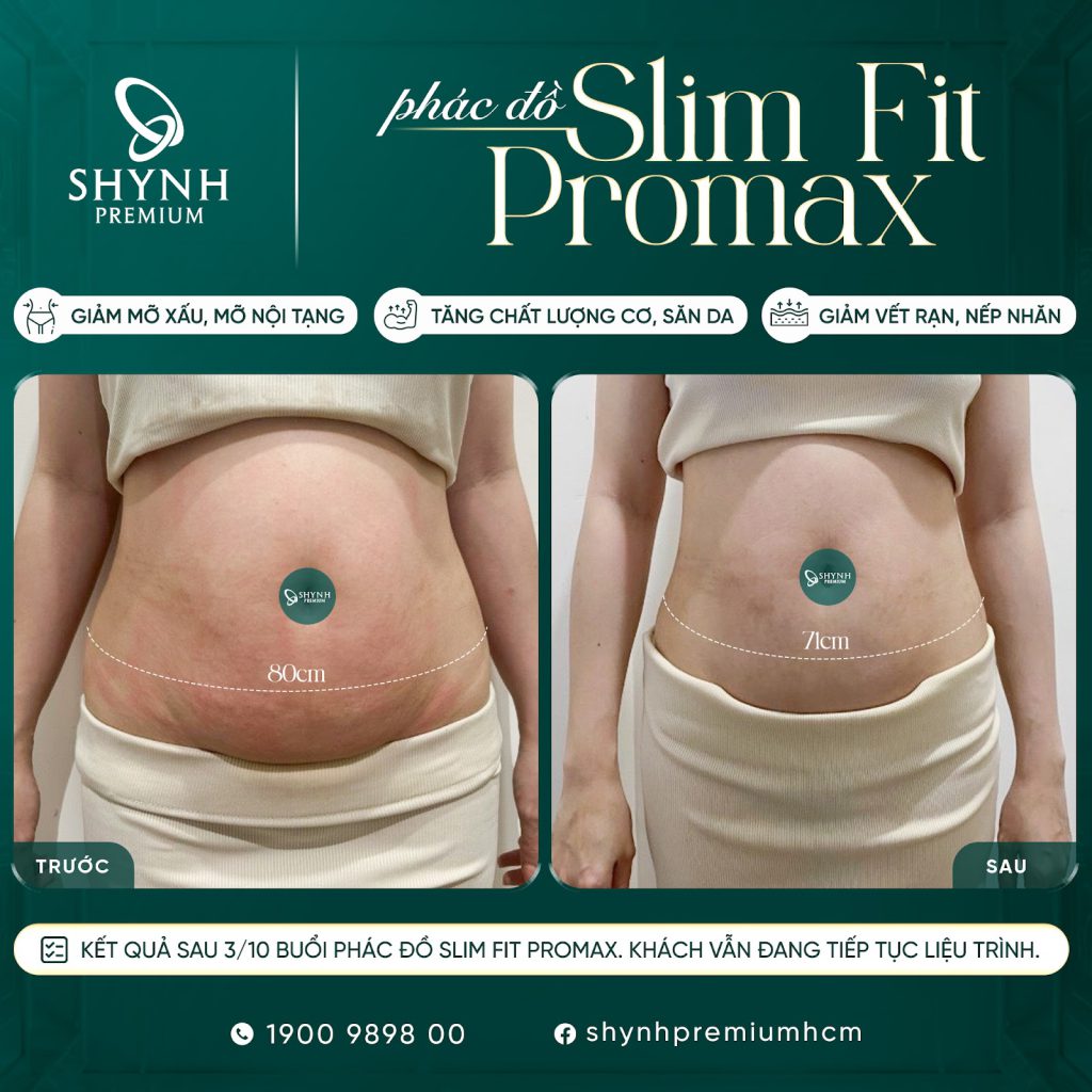 Slim Fit Promax AI là phác đồ độc quyền và hiệu quả tại Shynh Premium