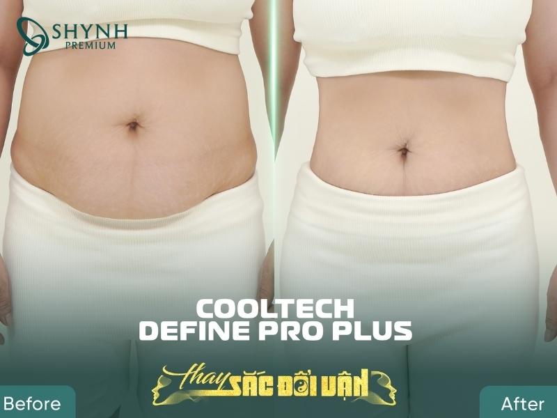 Hình ảnh thay đổi vòng 2 rõ rệt của khách hàng Shynh Premium