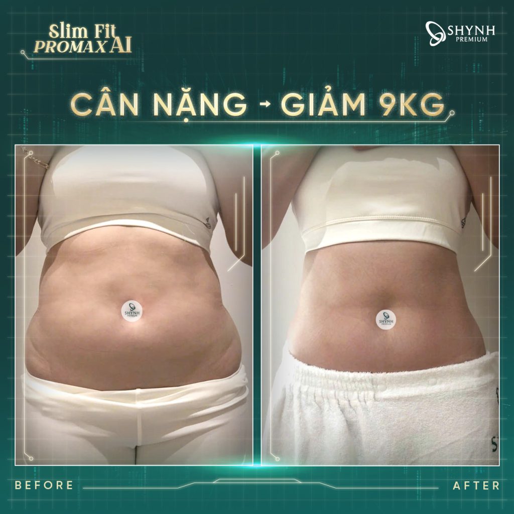 Phác đồ Slim Fit Promax AI giúp giảm cân cá nhân hóa theo từng khách hàng