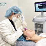 Thermage FLX giữ được bao lâu? Thời gian hiệu quả tối ưu