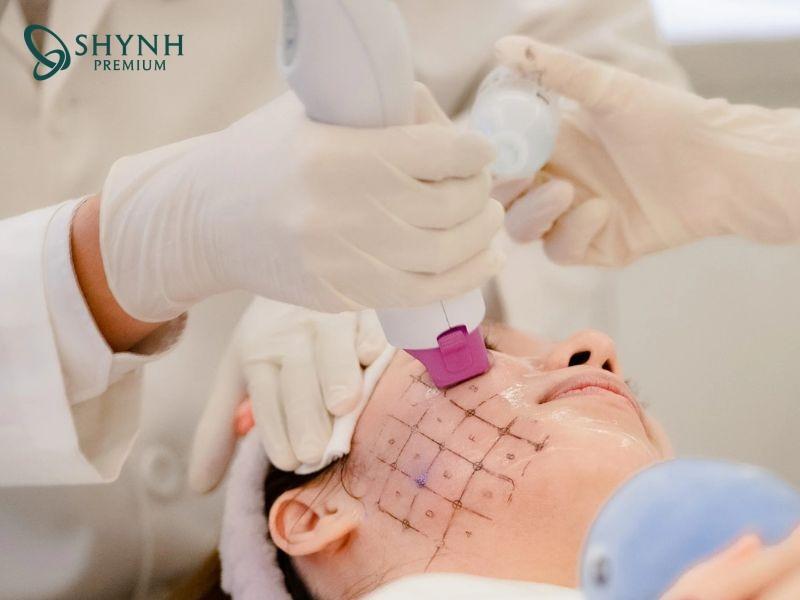 Thermage FLX có thể duy trì hiệu quả làm đẹp từ 1 đến 2 năm