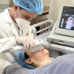 ultherapy có đau không
