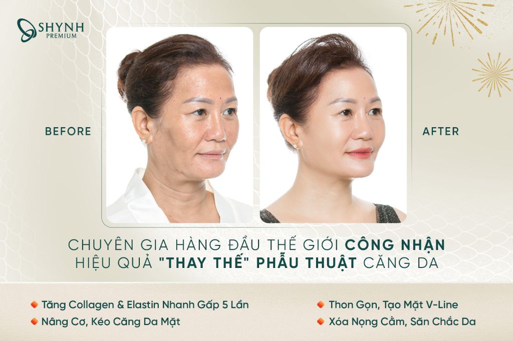 Hình ảnh khách hàng điều trị Therapy vùng mặt tại Shynh Premium