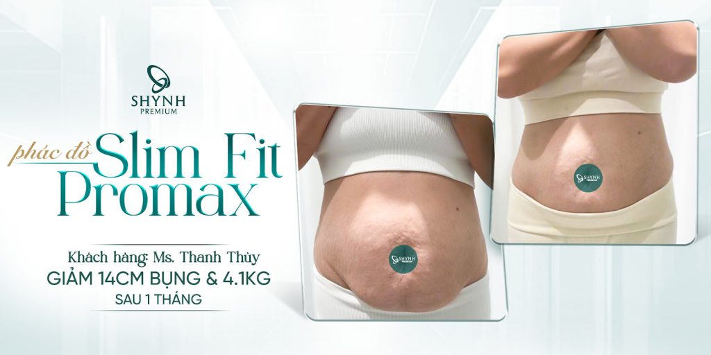 Phác đồ Slim Fit Pro Max AI giúp khách hàng Shynh Premium giảm đến 14cm vòng bụng