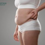 Cơ thể vẫn tích tụ mỡ trở lại sau khi hút mỡ, đặc biệt là mỡ nội tạng