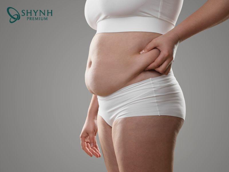 Cơ thể vẫn tích tụ mỡ trở lại sau khi hút mỡ, đặc biệt là mỡ nội tạng