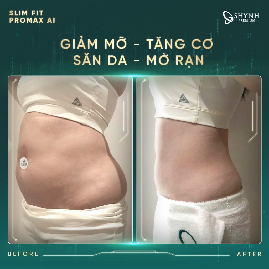 Sự thay đổi rõ rệt của khách hàng sau phác đồ Slim Fit Promax AI của Shynh Premium