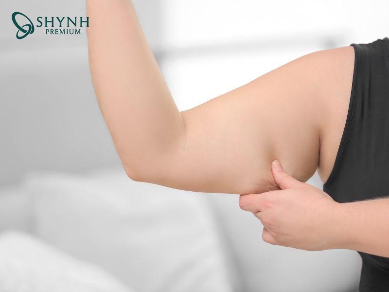 Mỡ bắp tay khó giảm do nhiều nguyên nhân khác nhau