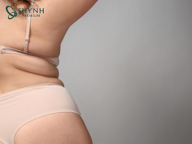 Có nhiều nguyên nhân khiến mỡ lưng dễ tích tụ