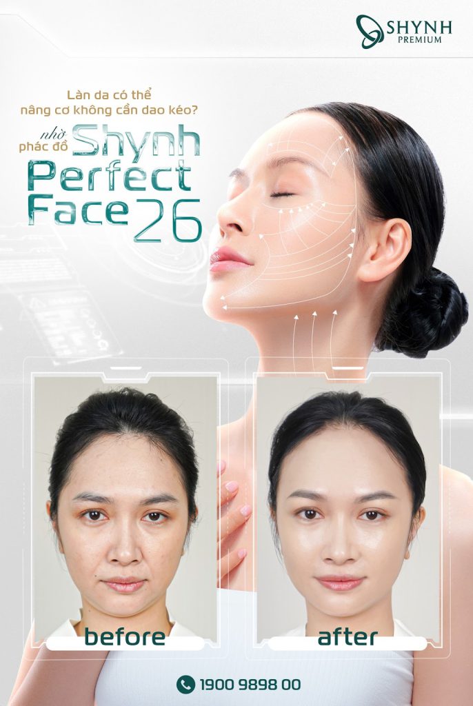 Phác đồ Shynh Perfect Face 26 được nhiều khách hàng ưa chuộng tại Shynh Premium