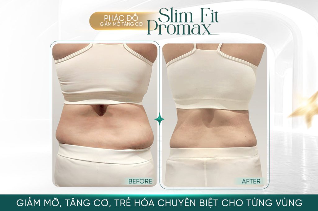 Phác đồ Slim Fit Promax AI tại Shynh Premium chuyên biệt cá nhân hoá theo thể trạng khách hàng