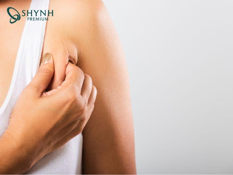 Mỡ nách tích tụ do nhiều nguyên nhân khác nhau