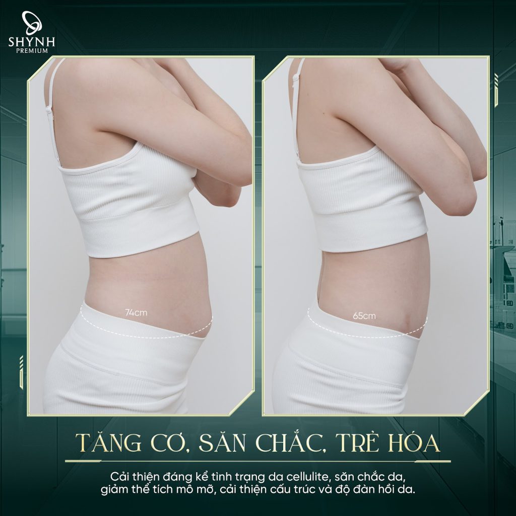Phác đồ Slim Fit Promax AI mang lại cho khách hàng vóc dáng thon gọn