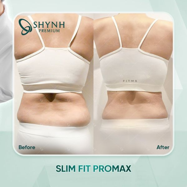 Phác đồ của Shynh Premium giúp khách hàng tăng cơ, giảm mỡ rõ rệt