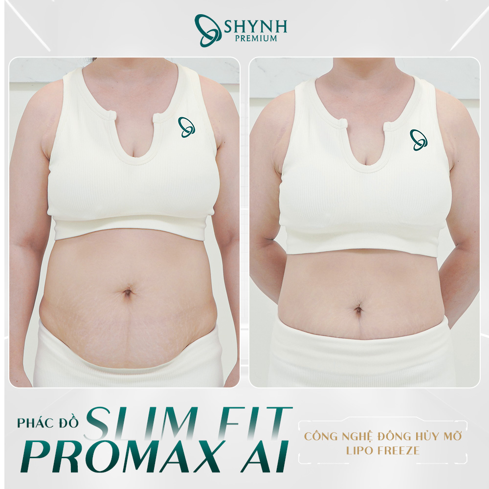 Phác đồ Slim Fit Promax AI của Shynh Premium giúp tối ưu hóa liệu trình cho nam và nữ