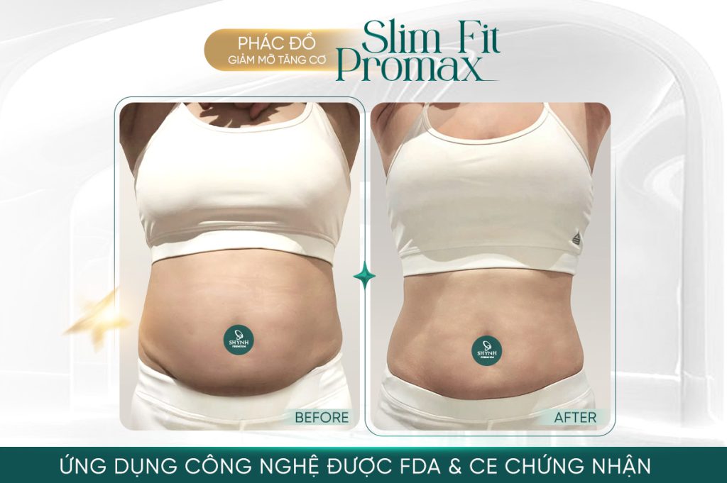 Phác đồ độc quyền của Shynh Premium giúp khách hàng giảm đến 25 kg mỡ thừa