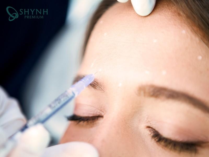 Tiêm botox căng da mặt là thủ thuật sử dụng protein tinh khiết botulinum toxin type A để cải thiện nếp nhăn trên da 