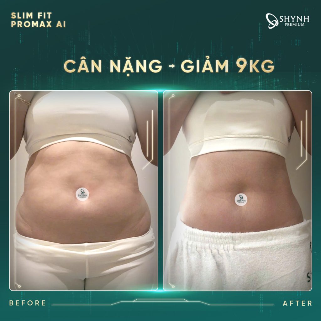 Phác đồ độc quyền của Shynh Premium giúp khách hàng giảm mỡ phù hợp với từng thể trạng mỗi người