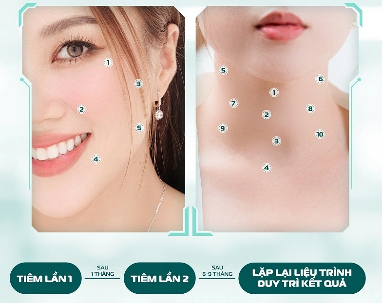Liệu trình Profhilo của Shynh Premium có thể duy trì hiệu quả từ 6-9 tháng