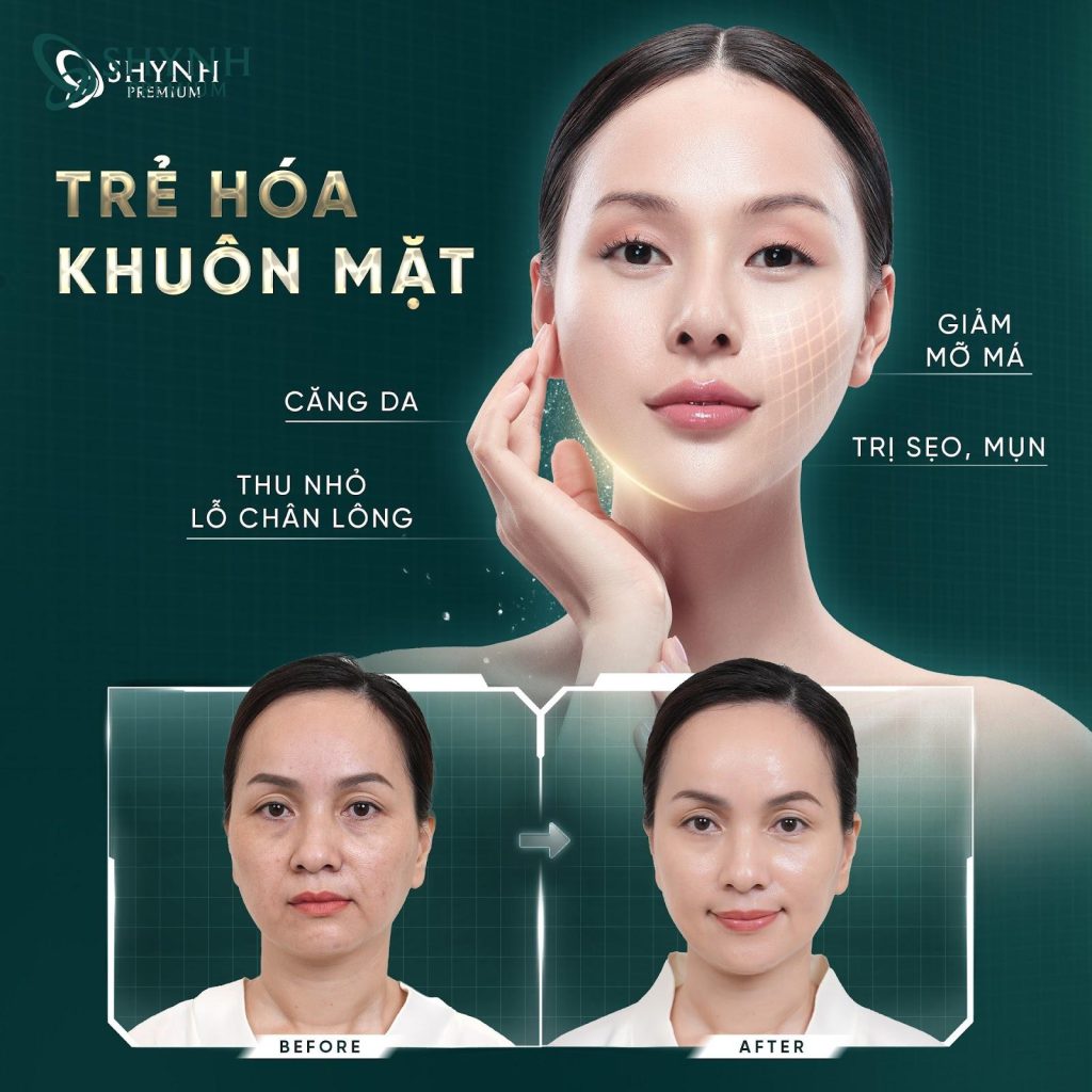 Các liệu pháp trẻ hóa da bằng công nghệ cao tại Shynh Premium an toàn và hiệu quả
