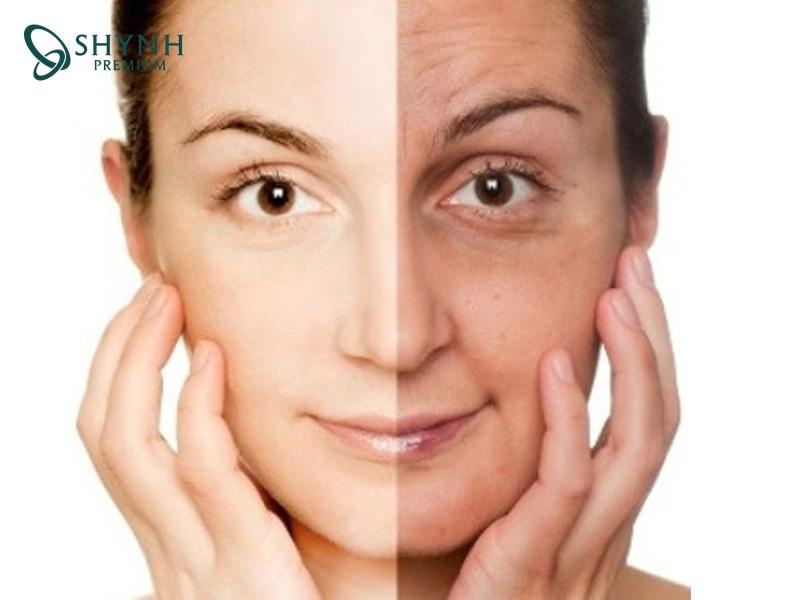 Da mặt thường dễ chùng xuống sau giảm cân