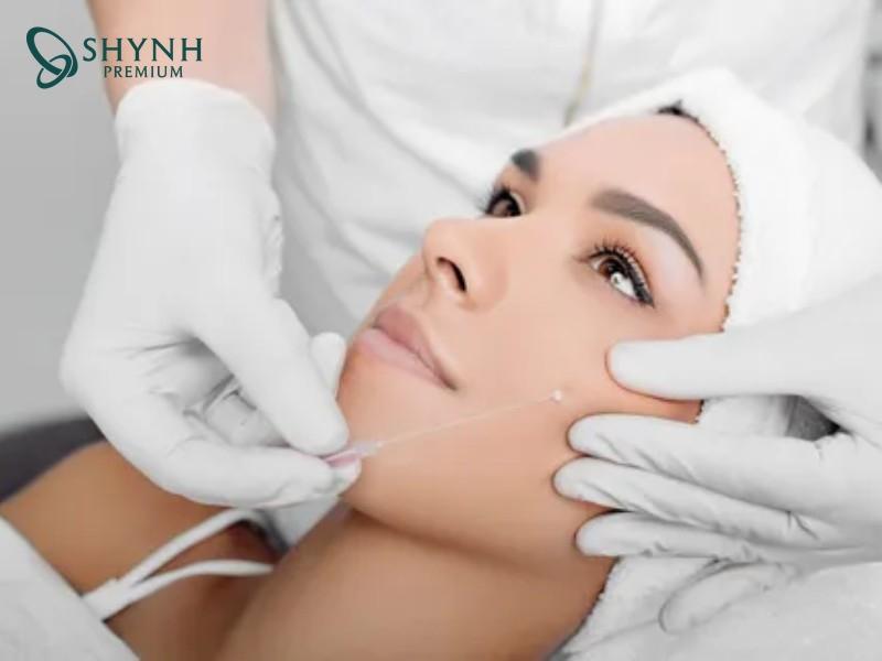 Hiệu quả căng chỉ da mặt duy trì khoảng 1–3 năm