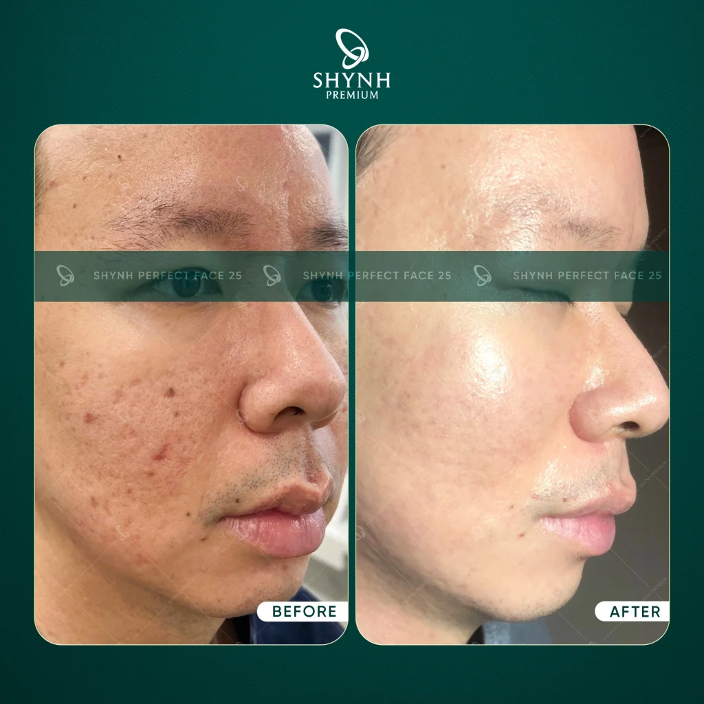 Hình ảnh này chưa có thuộc tính alt; tên tệp của nó là 487307041_1074062138091429_5445970783715270290_n-1-1024x1024.webp