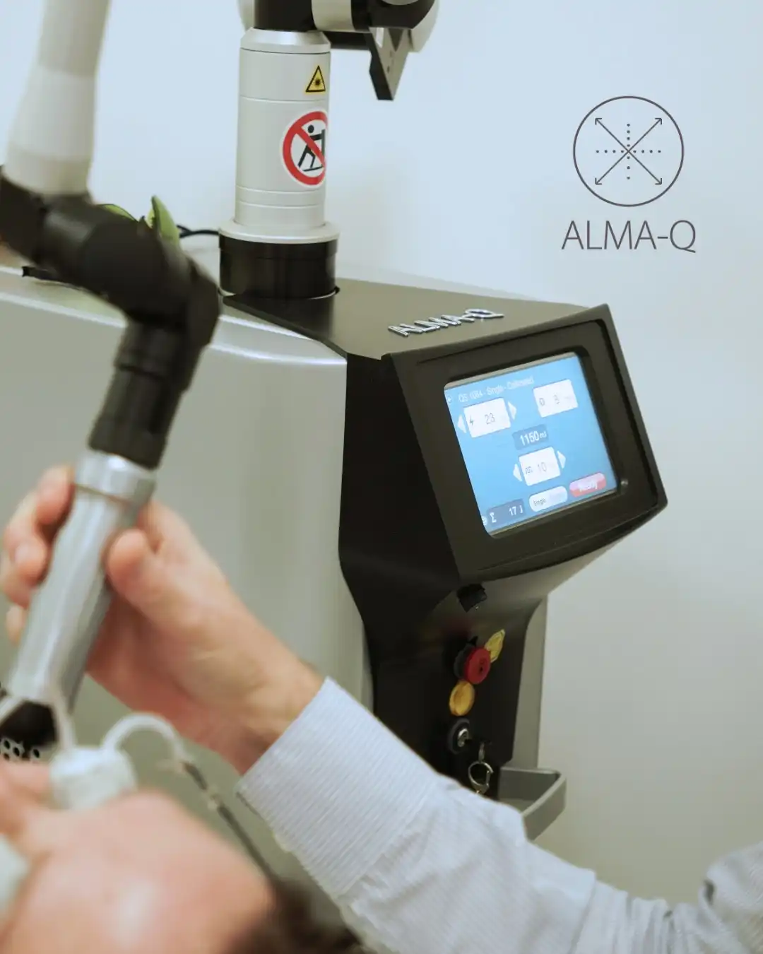 AlmaQ là nền tảng Laser Nd:YAG