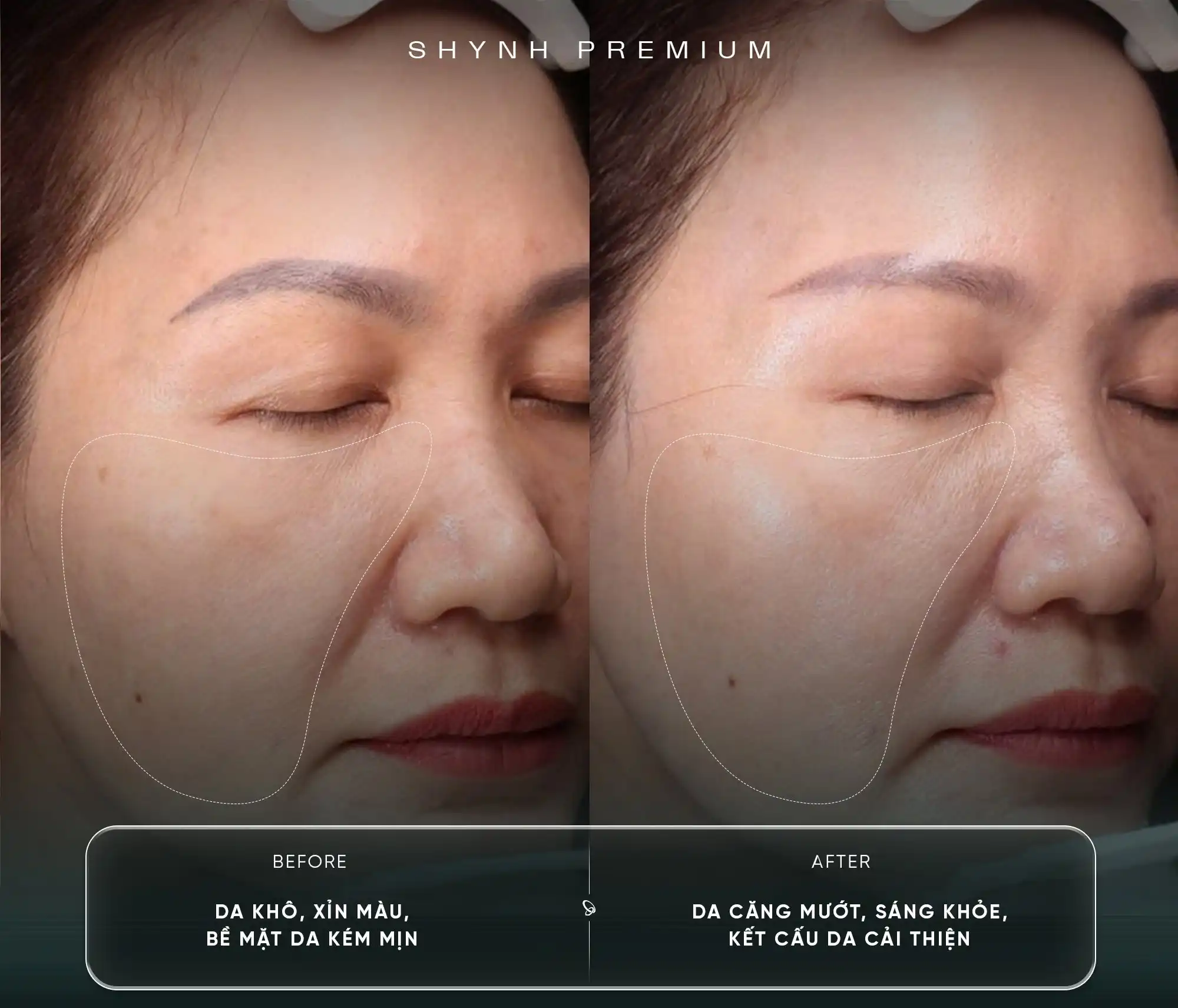khách hàng của Laser Alma - Q Luminous Pigment